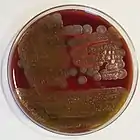 Bacillus cereus: "ground-glass" colonies displaying beta-hemolysis on blood agar: 188 