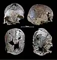 Burial 05 - Cranium